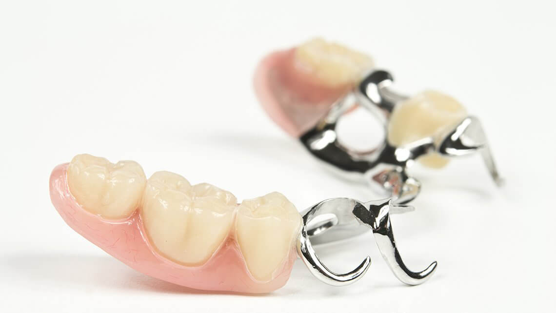 İmplant Destekli Hareketli Protezler