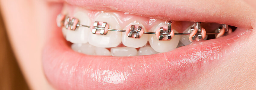 Yanlış Bilinen Gerçekler 3