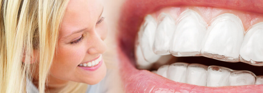 Yanlış Bilinen Gerçekler 4