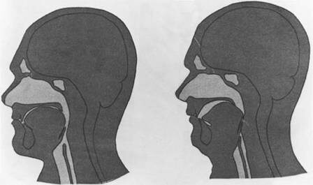 Açıklama: http://web.squ.edu.om/med-Lib/MED_CD/E_CDs/anesthesia/site/content/figures/3039F05.jpg